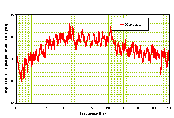 Processed Spectral data from patient